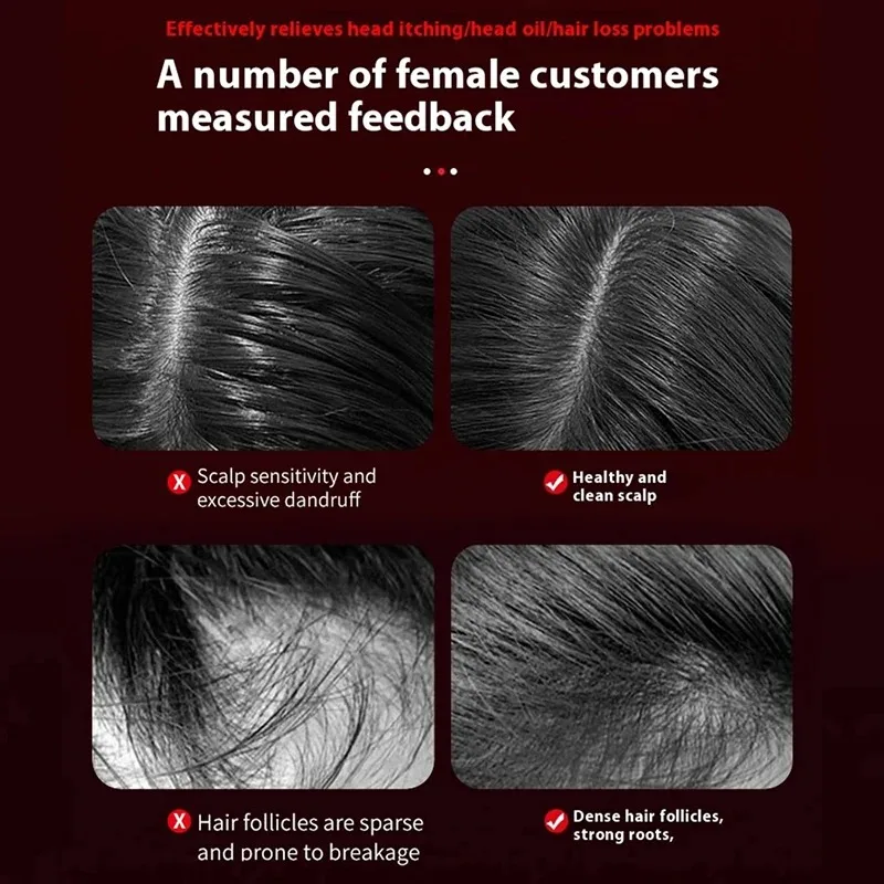 Electric Vibration Massage Com - огляд і ціна Hair Care Growth