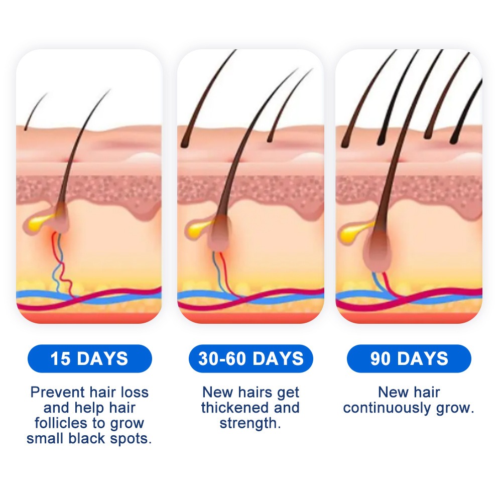 Alopecia Hair Growth Spray Sop - огляд і ціна Hair Care Growth