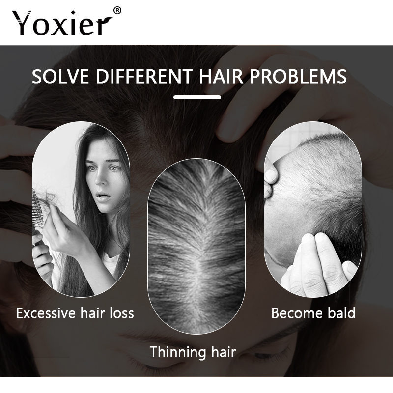 Intensive Growth Serum Prevent - огляд і ціна Hair Care Growth