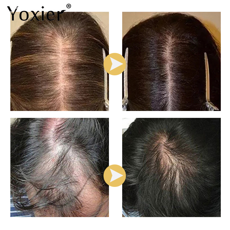 Intensive Growth Serum Prevent - огляд і ціна Hair Care Growth