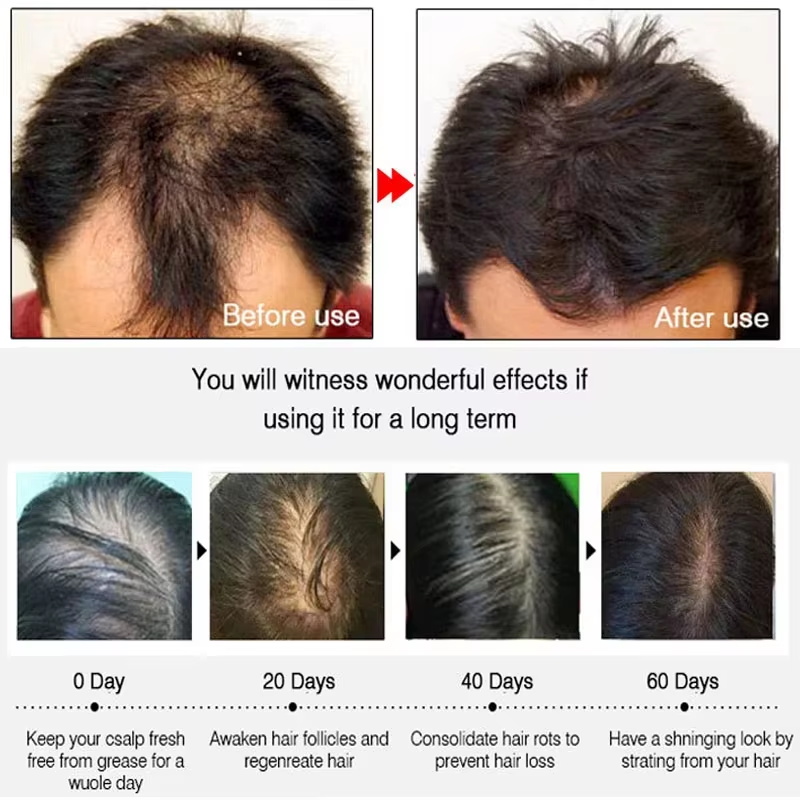 Fast Ginger Hair Growth Spray  - огляд і ціна Hair Care Growth