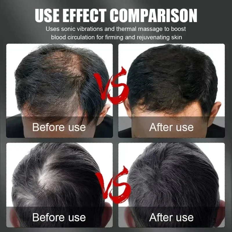 660nm 850nm Red Light Infrared - огляд і ціна Hair Care Growth